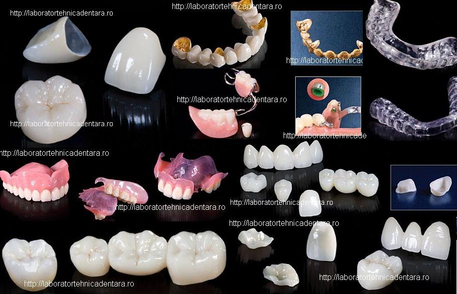 Implant Dent Tehnic Laborator Tehnica Dentara