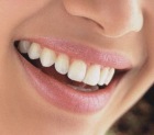 Albirea dintilor cu Opalescense